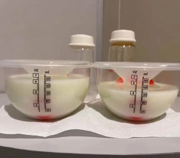 Janice’s Breastfeeding Journey with 2NutGuys